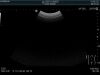 HITACHI C253 Ultrasound Transducer