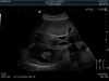 HITACHI C253 Ultrasound Transducer
