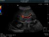 HITACHI C253 Ultrasound Transducer
