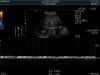 HITACHI C253 Ultrasound Transducer