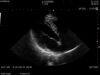 HITACHI S12 Ultrasound Transducer