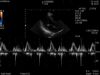 HITACHI S12 Ultrasound Transducer