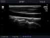 ALOKA UST-568 Ultrasound Transducer