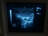 ALOKA UST-5512U Ultrasound Transducer
