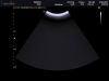 MEDISON C2-8 Ultrasound Transducer
