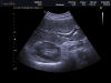 MEDISON C2-8 Ultrasound Transducer