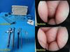 OLYMPUS A5306 10mmx0° Operating Laparoscope