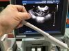 PHILIPS IU 22 Ultrasound Transducer