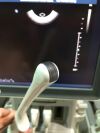 PHILIPS IU 22 Ultrasound Transducer