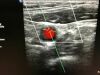 PHILIPS L9-3 Ultrasound Transducer