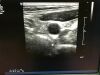 PHILIPS L9-3 Ultrasound Transducer