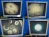 VTC BFW Thru-the-Lens Head Light Video Imaging W/ Light Source & Headlight
