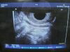 HITACHI EUP-R53W Ultrasound Transducer