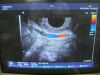 HITACHI EUP-R53W Ultrasound Transducer