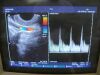 HITACHI EUP-R53W Ultrasound Transducer
