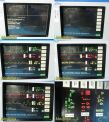 SPACELABS Ultraview 90369 Patient Monitoring System W/ Module & Leads~ Monitor