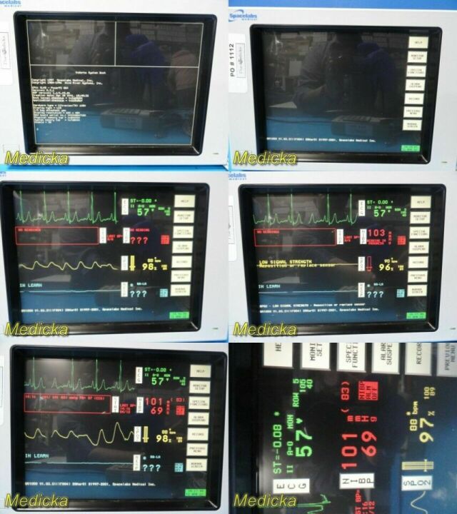 SPACELABS Ultraview 90369 Patient Monitoring System W/ Module & Leads~ Monitor