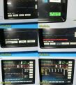 SPACELABS Ultraview 90369 Patient Monitoring System W/ Module & Leads~ Monitor