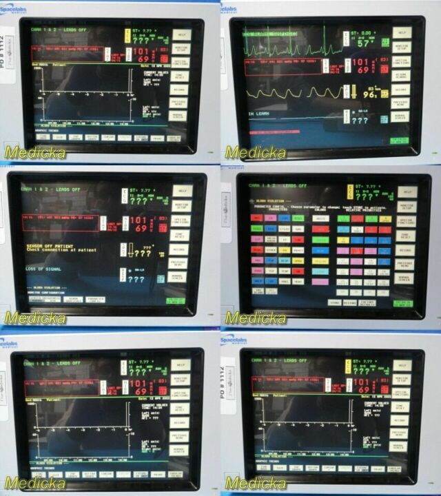 SPACELABS Ultraview 90369 Patient Monitoring System W/ Module & Leads~ Monitor