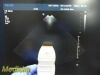 PHILIPS X3-1 P/N 453561176611 Matrix Phased Array Probe Ultrasound - Cardiac