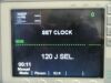 ZOLL E Series W/ Pacing Defibrillator