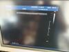 PHILIPS L17-5 Ultrasound Transducer