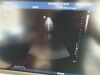 PHILIPS X7-2 Ultrasound Transducer