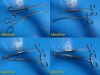 SKLAR Weck Wisap  Marlow Assorted  PELVISCOPY Instrument Set, GYN