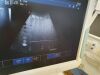 ESAOTE 9103518000 19" Monitor OB / GYN