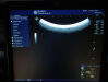 GE M6C-D Ultrasound Transducer
