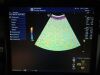 GE M6C-D Ultrasound Transducer