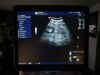 GE M6C-D Ultrasound Transducer