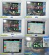 SPACELABS Ultraview 91369 Patient Monitoring System W/ Module, New Leads