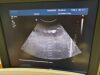 PHILIPS C5-2 Ultrasound Transducer