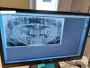 SIRONA Orthophos XG Dental X-Ray