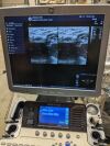 GE Logiq S7 Expert Ultrasound - Shared Service
