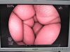 FUJINON EC-530LS Colonoscope
