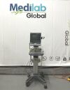 SONOSITE Mini Women's Health S Series Ultrasound - OB / GYN