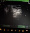 ESAOTE LA532E Ultrasound Transducer