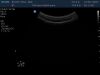 PHILIPS V6-2 Ultrasound Transducer