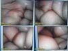 RICHARD WOLF 8934.421 PanoView Plus 0°x10mmrigid Telescope *CLEAR IMAGE*