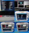 PHILIPS 2011 863071 Sure Signs VS3 Multi-Parameter Monitor