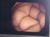 OLYMPUS PCF-H290I Colonoscope