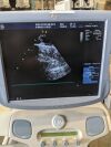 GE Vivid 7 Dimension Ultrasound - Cardiac