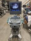 SIEMENS Acuson X300 Ultrasound - Shared Service