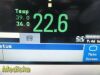 PHILIPS 2008  Intellivue MP20 Ref M8001A Monitor