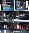 SPACELABS 90369 Vital Signs Patient Monitor