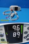 MASIMO 2012  Rad-87 Rainbow SpO2 Monitor