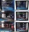 SPACELABS 90369 Multi-Parameter Patient Monitor