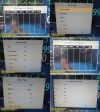 PHILIPS M8002A Intellivue MP30,W/ M3001A MMS Module & Leads ~, Monitor